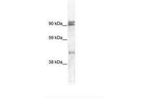 Image no. 1 for anti-Zinc Finger Protein 227 (ZNF227) (AA 118-167) antibody (ABIN6736006) (ZNF227 Antikörper  (AA 118-167))
