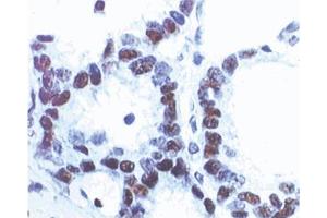 Immunohistochemistry (Paraffin-embedded Sections) (IHC (p)) image for anti-Tumor Protein P53 (TP53) antibody (ABIN967458)