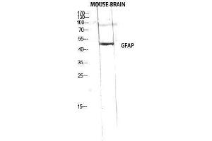 Western Blotting (WB) image for anti-Glial Fibrillary Acidic Protein (GFAP) (Ser423) antibody (ABIN3180065) (GFAP Antikörper  (Ser423))