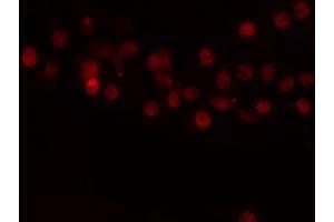 Immunofluorescence (fixed cells) (IF/ICC) image for anti-TEA Domain Family Member 1 (SV40 Transcriptional Enhancer Factor) (TEAD1) (Internal Region) antibody (ABIN6257778)