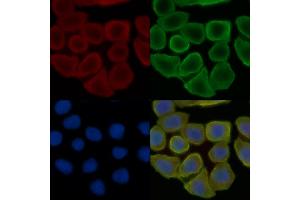 ABIN6257034 and ABIN6275778 staining Hela cells(30 min of UV treatment) by IF/ICC. (KRT37,38 (C-Term) Antikörper)