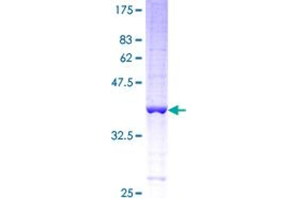 Hemoglobin, epsilon 1 (HBe1) (AA 1-147) protein (GST tag)