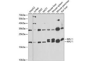 Western blot analysis of extracts of various cell lines, using RPL11 antibody (ABIN6129101, ABIN6147106, ABIN6147108 and ABIN6222040) at 1:1000 dilution. (RPL11 Antikörper  (AA 1-177))