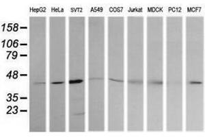 Image no. 7 for anti-Mitogen-Activated Protein Kinase Kinase 1 (MAP2K1) antibody (ABIN1499388) (MEK1 Antikörper)