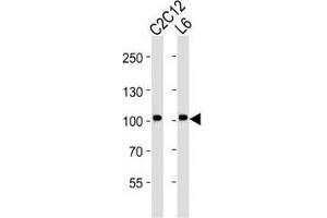 Western blot analysis of lysate from C2C12, L6 cell line (left to right) using Musk antibody at 1:2000 for each lane. (MUSK Antikörper)