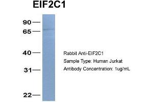 Host: Rabbit Target Name: EIF2C1 Sample Type: Jurkat Antibody Dilution: 1. (AGO1 Antikörper  (N-Term))