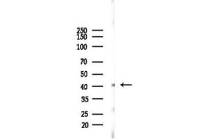 anti-Potassium Channel Subfamily K Member 15 (KCNK15) (C-Term) antibody