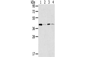 Gel: 8 % SDS-PAGE,Lysate: 40 μg,Lane 1-4: 293T cells, K562 cells, Lovo cells, Human bladder carcinoma tissue,Primary antibody: ABIN7191340(MAGEA11 Antibody) at dilution 1/200 dilution,Secondary antibody: Goat anti rabbit IgG at 1/8000 dilution,Exposure time: 30 seconds (MAGEA11 Antikörper)