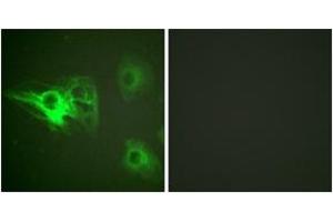 Immunofluorescence analysis of HeLa cells, using Keratin 8 (Phospho-Ser432) Antibody. (KRT8 Antikörper  (pSer432))