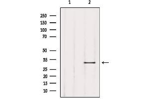 Western blot analysis of extracts from Mouse lung, using TRIO Antibody. (TRIO Antikörper  (Internal Region))
