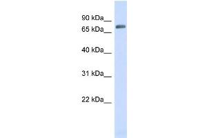 WB Suggested Anti-TRIM41 Antibody Titration:  0. (TRIM41 Antikörper  (N-Term))