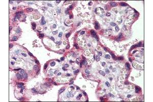 Placenta, Human: Formalin-Fixed, Paraffin-Embedded (FFPE) (CCR4 Antikörper  (Extracellular Domain))
