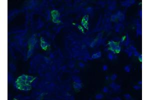 Image no. 1 for anti-Keratin 7 (KRT7) antibody (ABIN335336) (Cytokeratin 7 Antikörper)