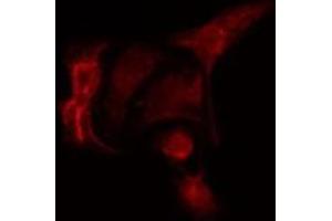 Immunofluorescence (fixed cells) (IF/ICC) image for anti-Protein Phosphatase 2, Regulatory Subunit B' alpha (PPP2R5A) (Internal Region) antibody (ABIN6259159)