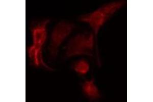 ABIN6275546 staining  HuvEc cells by IF/ICC. (PPP2R5A Antikörper  (Internal Region))
