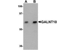 Western Blotting (WB) image for anti-UDP-N-Acetyl-alpha-D-Galactosamine:polypeptide N-Acetylgalactosaminyltransferase 10 (GalNAc-T10) (GALNT10) (C-Term) antibody (ABIN1030404)