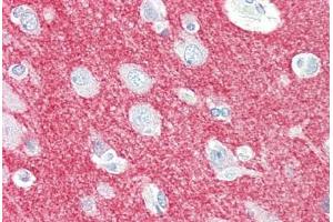 Human Brain, Cortex (formalin-fixed, paraffin-embedded) stained with CRMP1 antibody ABIN461920 at 5 ug/ml followed by biotinylated goat anti-rabbit IgG secondary antibody ABIN481713, alkaline phosphatase-streptavidin and chromogen. (CRMP1 Antikörper  (N-Term))
