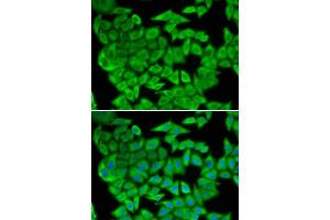 Immunofluorescence (IF) image for anti-Malate Dehydrogenase 2, NAD (Mitochondrial) (MDH2) antibody (ABIN1980313) (MDH2 Antikörper)