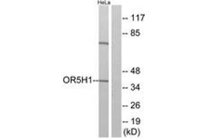 Western blot analysis of extracts from HeLa cells, using OR5H1 Antibody. (OR5H1 Antikörper  (AA 262-311))