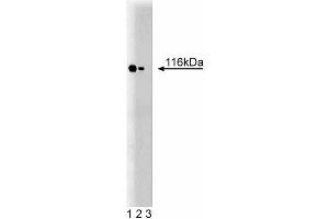 Western blot analysis of TAO1 on a rat cerebrum lysate. (TAO Kinase 2 Antikörper  (AA 352-550))