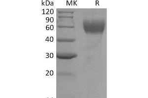 Western Blotting (WB) image for Interleukin 1 Receptor, Type I (IL1R1) protein (His tag) (ABIN7320826)