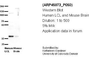 Image no. 2 for anti-Chromosome 21 Open Reading Frame 59 (C21orf59) (N-Term) antibody (ABIN405773) (C21orf59 Antikörper  (N-Term))