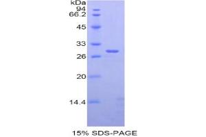SDS-PAGE analysis of Rat ADAM6 Protein. (ADAM6A Protein)