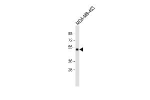 All lanes : Anti-GABRD Antibody (Center) at 1:2000 dilution Lane 1: MDA-MB-453 whole cell lysate Lysates/proteins at 20 μg per lane. (GABRD Antikörper  (AA 331-358))