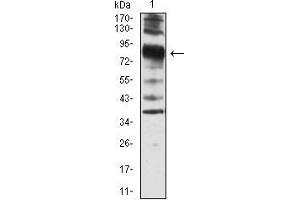 Western Blotting (WB) image for anti-Villin 1 (VIL1) (AA 1-209) antibody (ABIN5542405)
