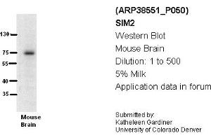 Image no. 1 for anti-Single-Minded Homolog 2 (SIM2) (N-Term) antibody (ABIN501700)