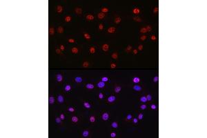 Immunofluorescence analysis of NIH/3T3 cells using DDX39A antibody (ABIN6131590, ABIN6139489, ABIN6139491 and ABIN6223963) at dilution of 1:50. (DDX39 Antikörper  (AA 178-427))