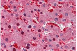 Human Liver: Formalin-Fixed, Paraffin-Embedded (FFPE) (IDH1 Antikörper  (AA 30-307))