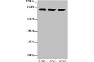 Western blot All lanes: AP4B1 antibody at 3 μg/mL Lane 1: HepG2 whole cell lysate Lane 2: U251 whole cell lysate Lane 3: LO2 whole cell lysate Secondary Goat polyclonal to rabbit IgG at 1/10000 dilution Predicted band size: 84, 35 kDa Observed band size: 84 kDa (AP4B1 Antikörper  (AA 201-500))