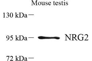 Western blot analysis of NRG2 (ABIN7074804) at dilution of 1: 500 (Neuregulin 2 Antikörper)