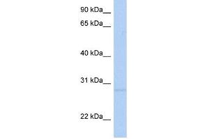 WB Suggested Anti-RNF41 Antibody Titration:  0. (RNF41 Antikörper  (Middle Region))