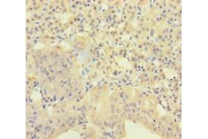 Immunohistochemistry of paraffin-embedded human adrenal gland tissue using ABIN7143593 at dilution of 1:100