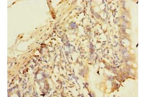 Immunohistochemistry of paraffin-embedded human small intestine tissue using ABIN7163662 at dilution of 1:100 (C10orf81 Antikörper  (AA 181-462))
