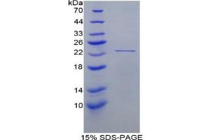 SDS-PAGE analysis of Human Peroxiredoxin 1 Protein. (Peroxiredoxin 1 Protein (PRDX1))