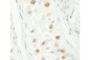 Immunohistochemistry (IHC) image for anti-Checkpoint Kinase 1 (CHEK1) (AA 250-300) antibody (ABIN7448476)
