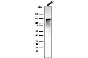 Western Blot Analysis of human ovary tissue lysate using Caldesmon Rabbit Recombinant Monoclonal Antibody (CALD1/1424R). (Rekombinanter Caldesmon Antikörper)