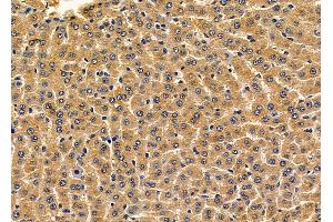 ABIN6264816 and ABIN6279786 at 1/100 staining rat liver tissue by IHC-P. (RPAP3 Antikörper  (N-Term))