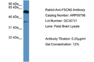 WB Suggested Anti-FSCN2  Antibody Titration: 0. (Fascin 2 Antikörper  (Middle Region))