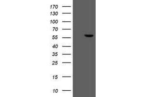 Western Blotting (WB) image for anti-Formiminotransferase Cyclodeaminase (FTCD) antibody (ABIN1496377) (FTCD Antikörper)