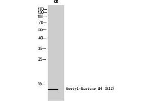 Western Blot analysis of KB cells using Acetyl-Histone H4 (K12) Polyclonal Antibody diluted at 1:500.