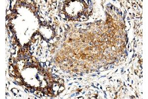 IHC analysis of MORC3 using anti-MORC3 antibody (ABIN7602764).