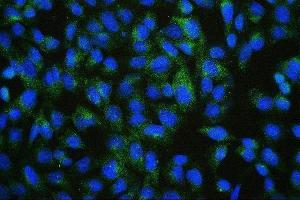 IF analysis of PDCD6IP using anti-PDCD6IP antibody (ABIN7600490). (ALIX Antikörper  (AA 2-330))