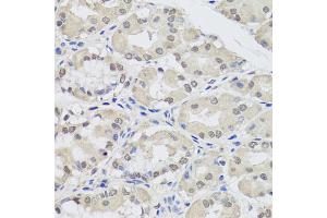 Immunohistochemistry of paraffin-embedded human stomach using AGO2 antibody (ABIN5974124) at dilution of 1/100 (40x lens). (AGO2 Antikörper)