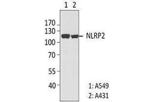 Western Blotting (WB) image for anti-NLR Family, Pyrin Domain Containing 2 (NLRP2) antibody (ABIN2666255) (NLRP2 Antikörper)