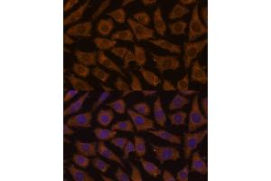 Immunofluorescence analysis of L929 cells using MTMR4 Polyclonal Antibody (ABIN7268764) at dilution of 1:100 (40x lens). (MTMR4 Antikörper  (AA 920-1195))