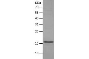 Western Blotting (WB) image for Mdm2, p53 E3 Ubiquitin Protein Ligase Homolog (Mouse) (MDM2) (AA 1-118) protein (His tag) (ABIN7123867)
